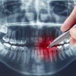 AdobeStock_38131104-1600x1600